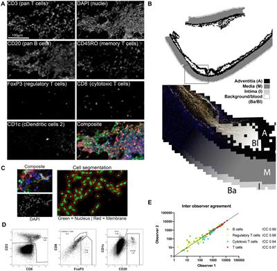 Adventitial adaptive immune cells are associated with ascending aortic dilatation in patients with a bicuspid aortic valve